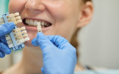 ایمپلنت دندان چیست؟ مزایا، عوارض، هزینه و مراحل انجام