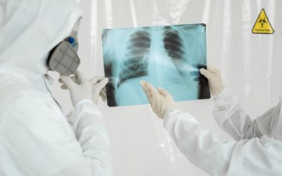 خطرات و عوارض رادیولوژی و رادیوگرافی چیست؟