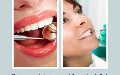 فرق لمینت و کامپوزیت دندان چیست؟