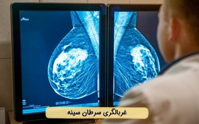 غربالگری سرطان سینه یا پستان چیست؟