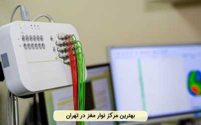 بهترین مرکز نوار مغز در تهران کجاست؟