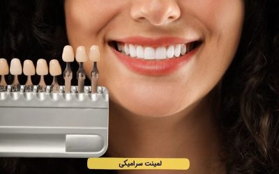 لمینت سرامیکی دندان: کاربرد، انواع، ماندگاری و معایب