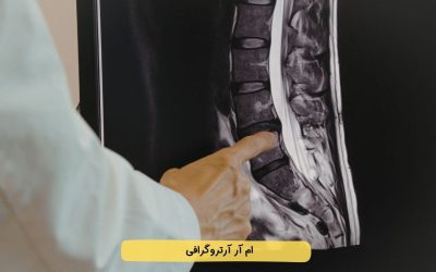 درباره ام آر آرتروگرافی بیشتر بدانید
