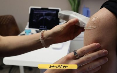 درباره سونوگرافی مفصل و تاندون بیشتر بدانید