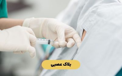 بلاک عصبی: انواع و کاربرد