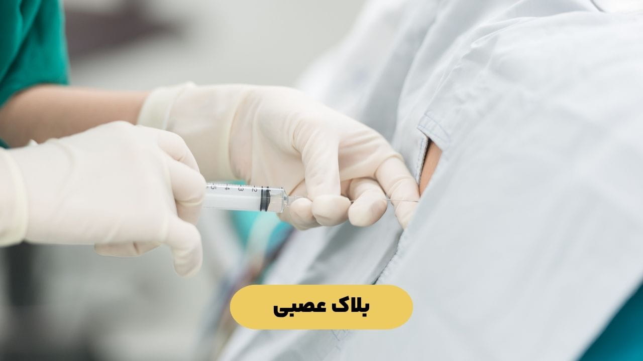 بلاک عصبی بلاک عصبی