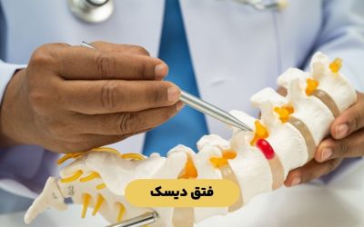 درباره فتق دیسک کمر و گردن بیشتر بدانید.